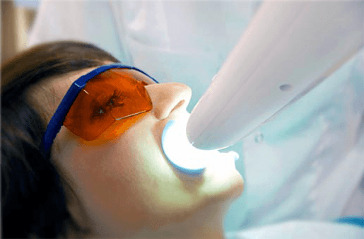 Understanding the Causes of Teeth Sensitivity Beckenham