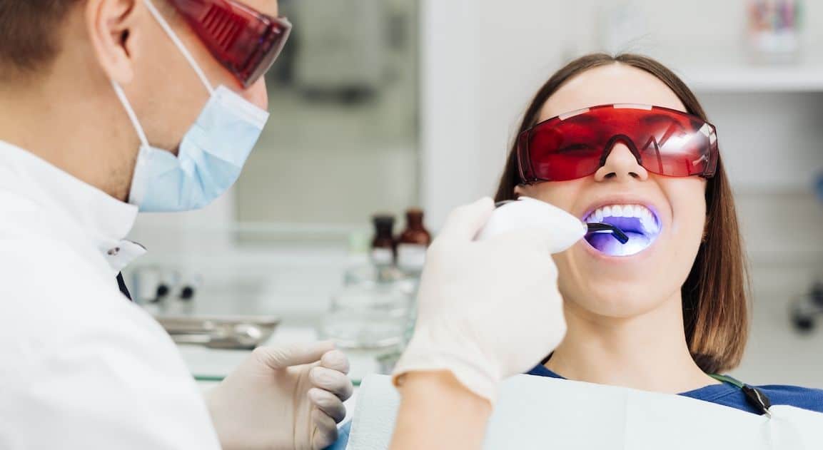 Do Dental Crowns Change Colour After Teeth Whitening Beckenham?