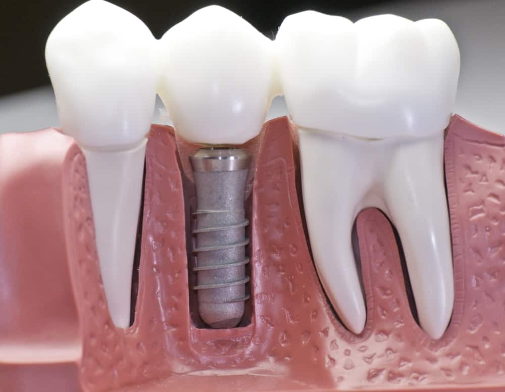 Common Misconceptions About Modern Dental Treatments Beckenham