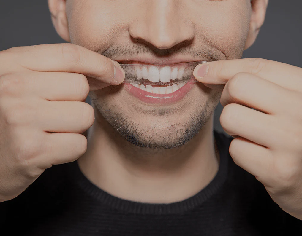 Can You Whiten Natural Teeth Without Harsh Chemicals Beckenham?