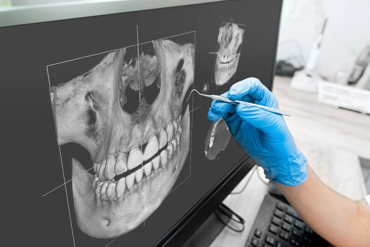 Key Benefits of 3D Printing for Patients and Dentists Beckenham