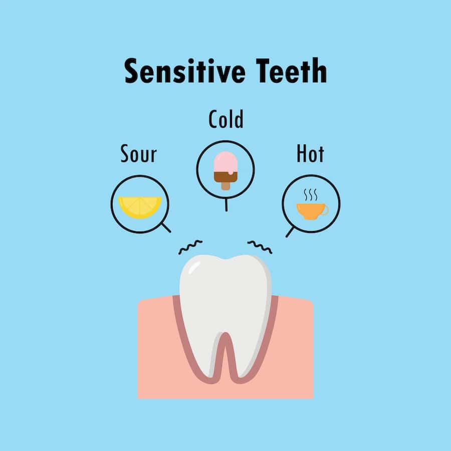 How Can You Tell If Your Teeth Are Becoming Sensitive Beckenham?