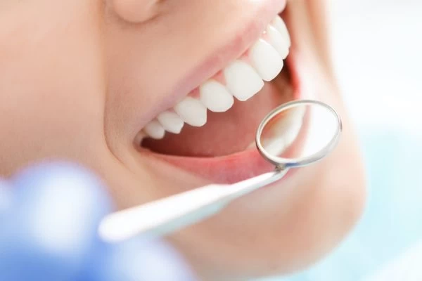Preventing White Spots on Teeth Beckenham