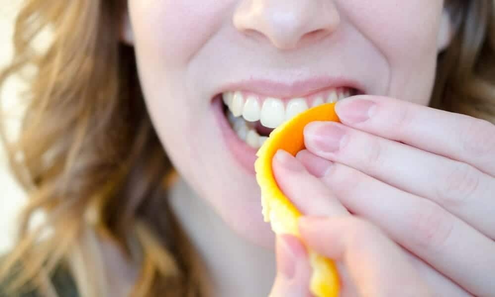 How Long Does Natural Teeth Whitening Take to Show Results Beckenham?