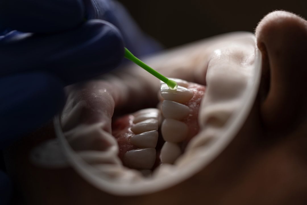 How Saliva Protects Your Teeth and Gums Beckenham