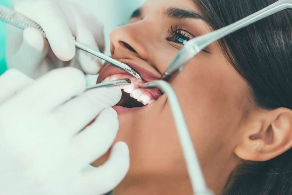 Braces Are Just for Kids – Myth or Reality Beckenham