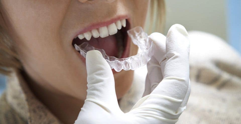 Can Bruxism Affect Your Sleep Quality Beckenham