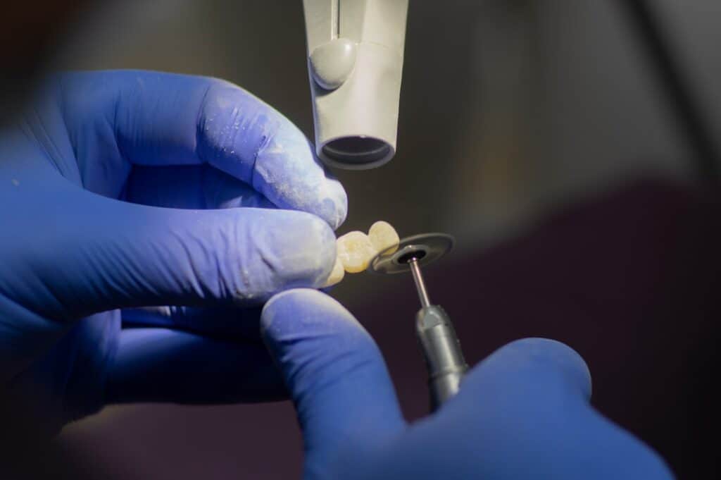 Customised Dental Solutions: Crowns, Aligners, and Implants Beckenham