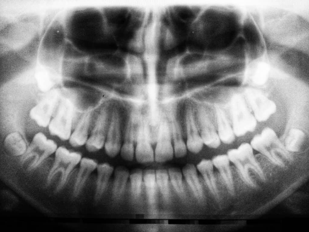 The Future of 3D Printing in Oral Healthcare Beckenham